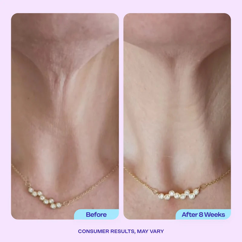 Eterna Lift Neck Cream