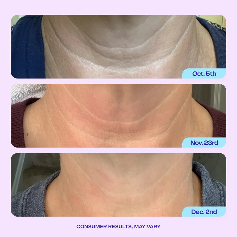 Eterna Lift Neck Cream