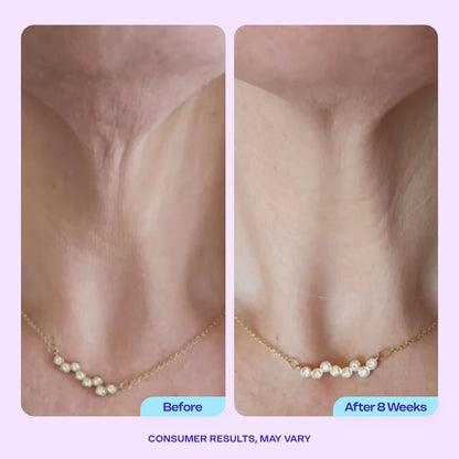 Eterna Lift Neck Cream