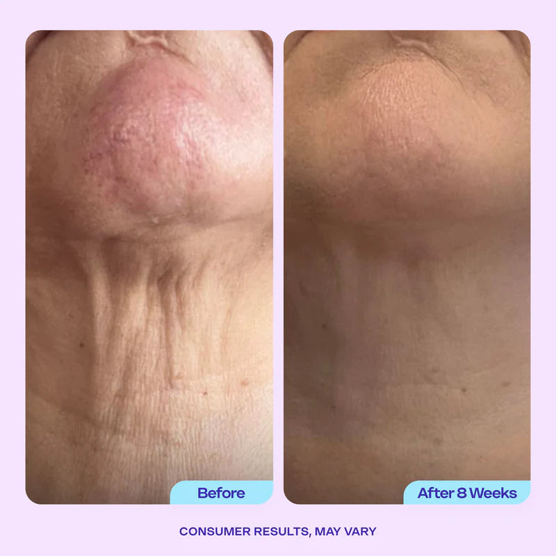 Eterna Lift Neck Cream